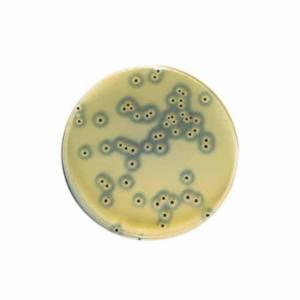 Biokar BAIRD-PARKER Agar-Dehydrated base medium BK055HA