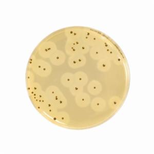 Biokar EASY Staph® Agar - Dehydrated base medium 500 grammes BK216HA Biokar EASY Staph® Agar - Dehydrated base medium 500 grammes BK216HA